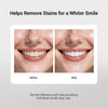 MSDRWIKEY 7-Pro Whitening Toothpaste