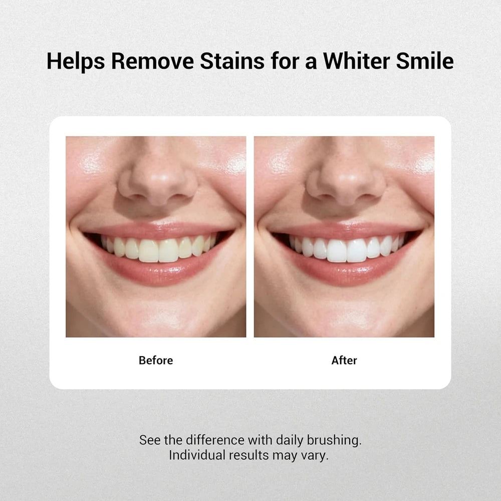 MSDRWIKEY 7-Pro Whitening Toothpaste